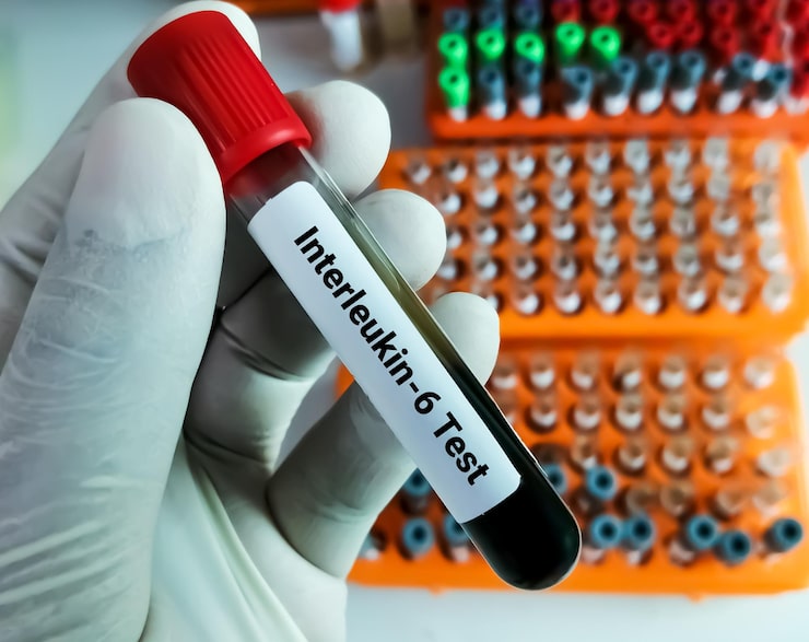 Blood sample labeled for advanced lipids testing to evaluate cholesterol particles and cardiovascular risk.