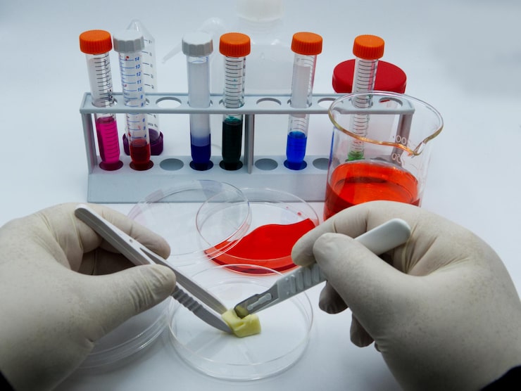 Laboratory technician analyzing blood samples for heavy metals testing and toxic exposure evaluation.