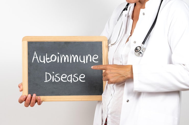 Doctor holding an autoimmune disease sign to explain common symptoms and diagnosis.