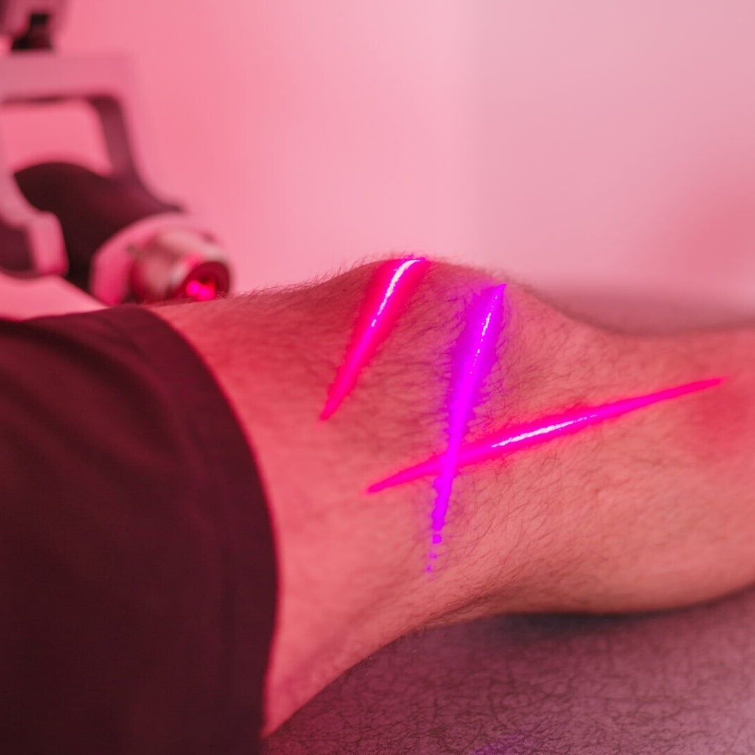 Patient receiving FX 405 cold laser therapy on the neck to reduce pain and inflammation